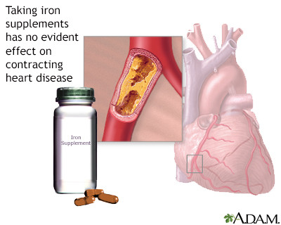 What Food Is High in Iron?