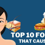 Assortment of foods known to cause acne, including dairy, sugary snacks, and processed foods
